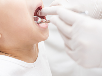 先天性欠損歯・エナメル質形成不全症・歯の発育異常にも対応